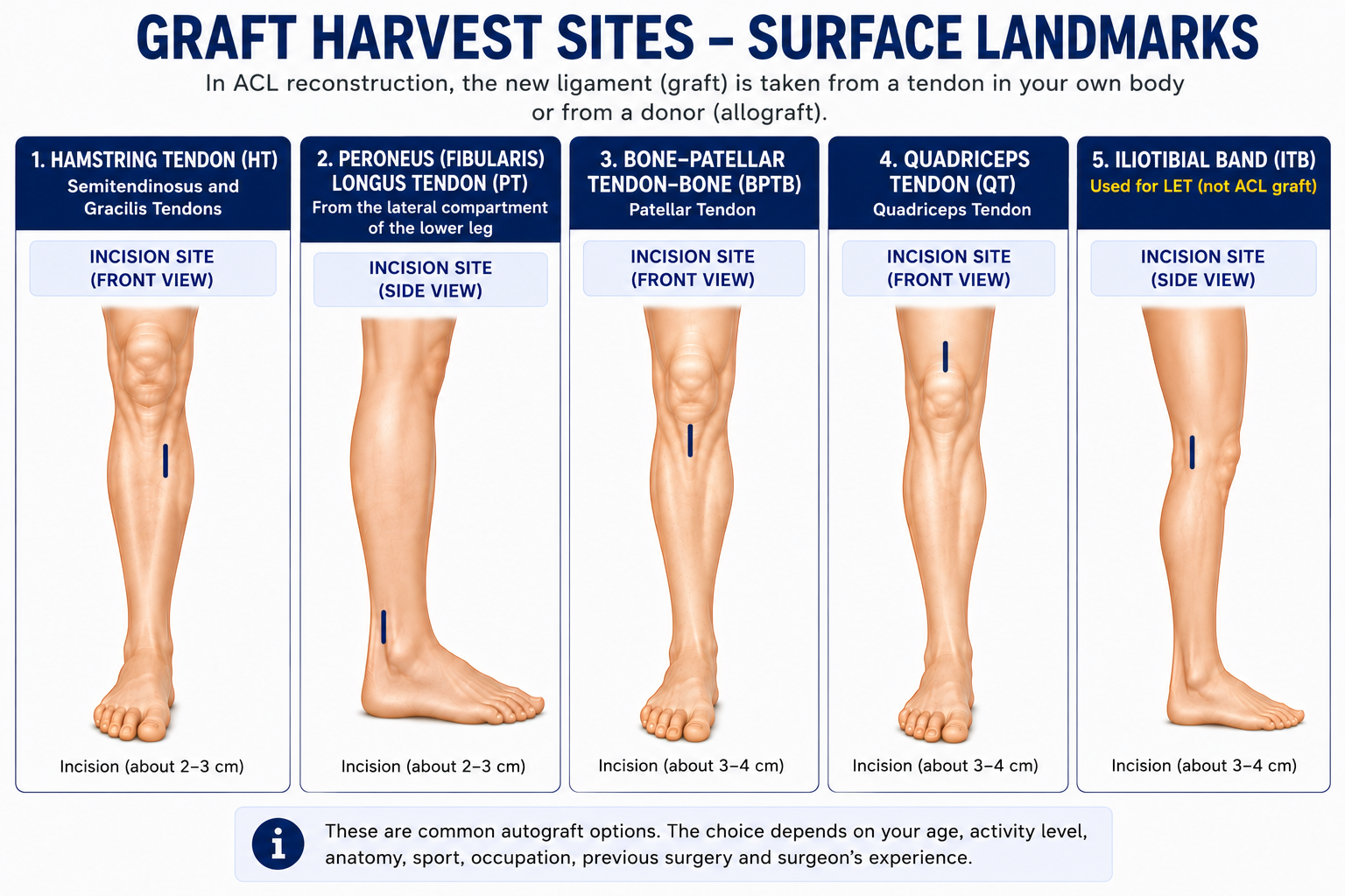 Surface landmarks and incision sites for ACL graft harvest: hamstring, peroneus longus, bone-patellar tendon-bone, quadriceps tendon, and iliotibial band used for LET.