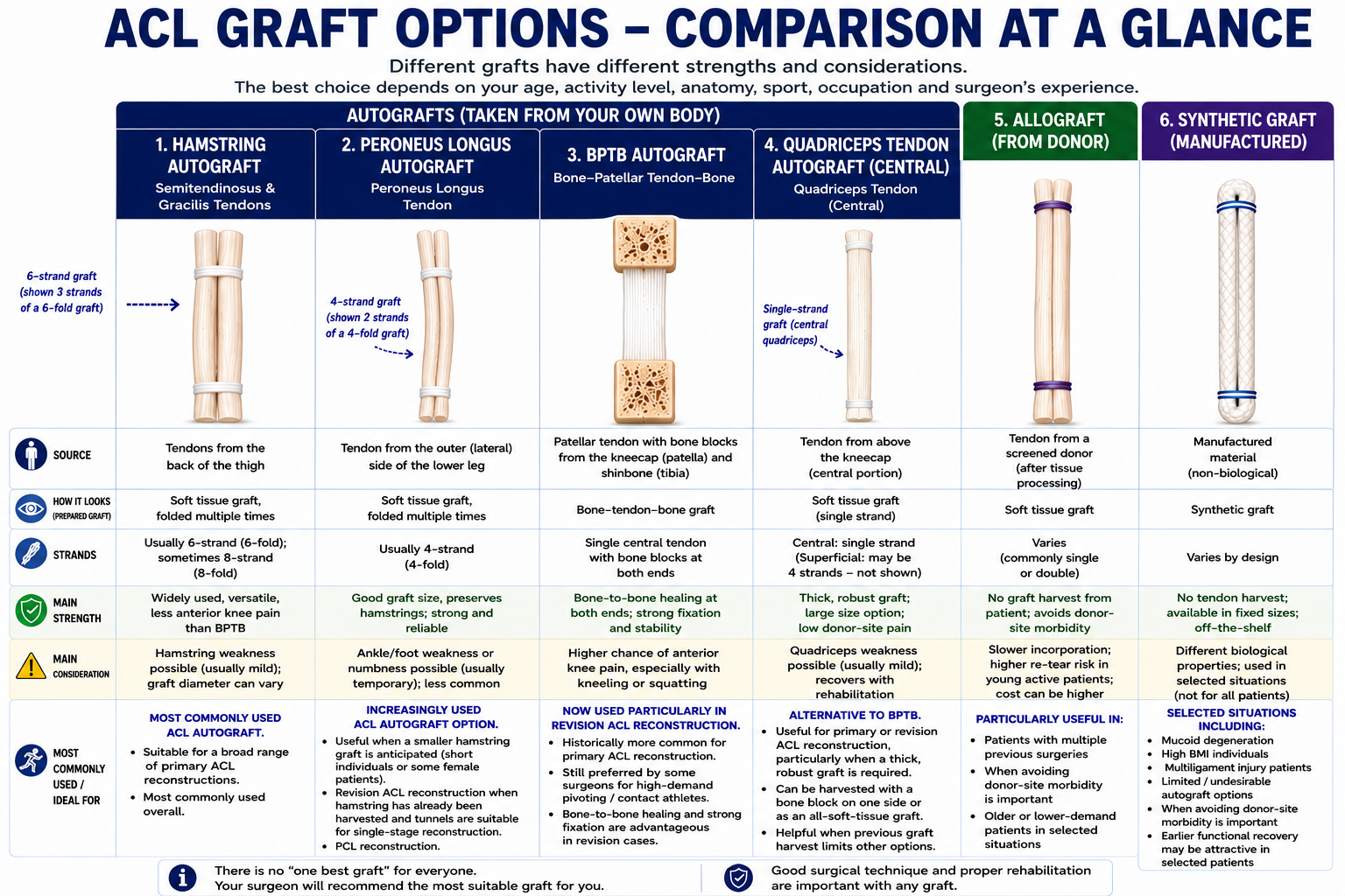 Comparison of ACL graft options at a glance: hamstring, peroneus longus, BPTB, quadriceps tendon, allograft and synthetic graft, with their source, strengths and main considerations.