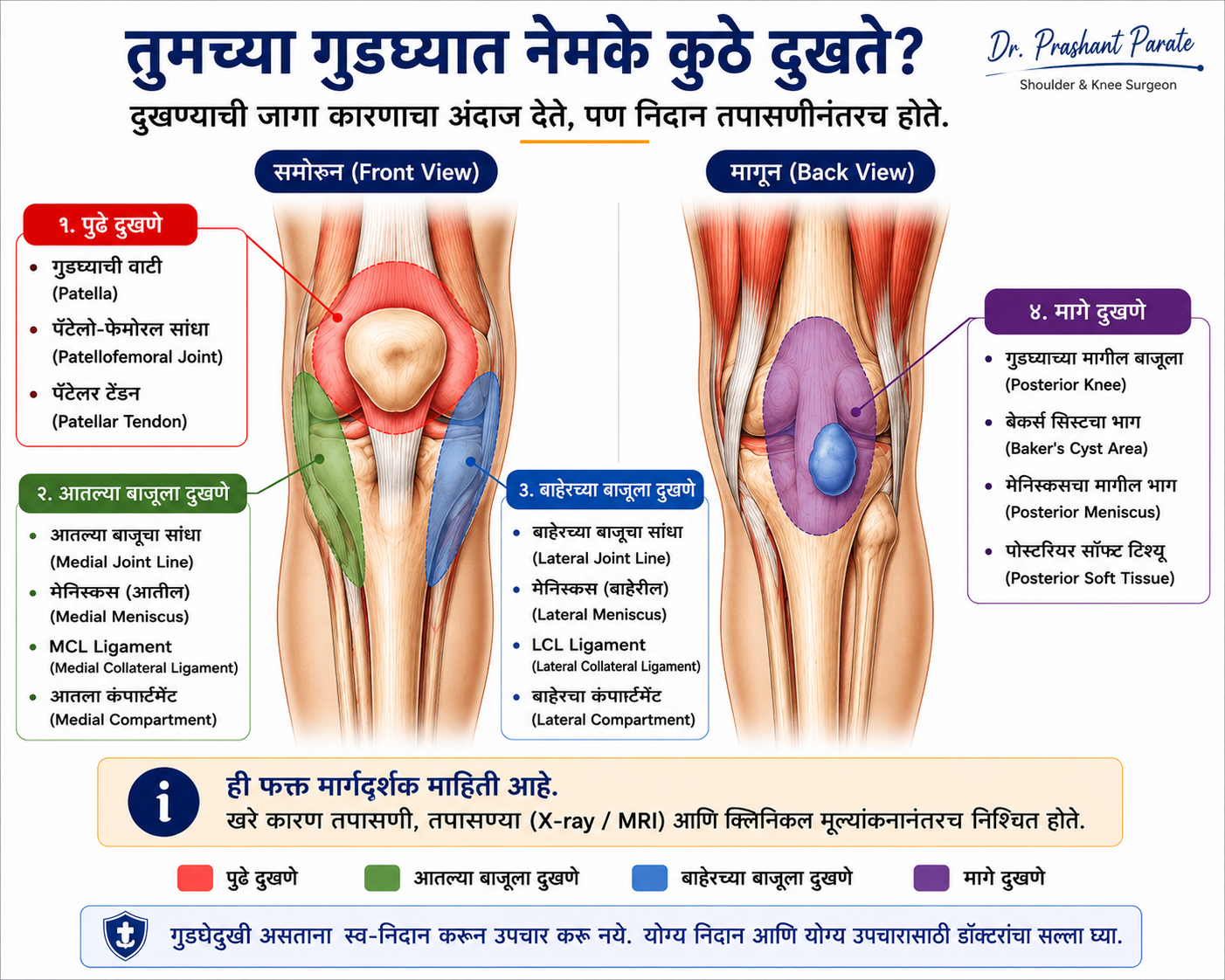 तुमच्या गुडघ्यात नेमके कुठे दुखते? पुढे, आतल्या बाजूला, बाहेरच्या बाजूला आणि मागे दुखण्याची कारणे. डॉ. प्रशांत पराते