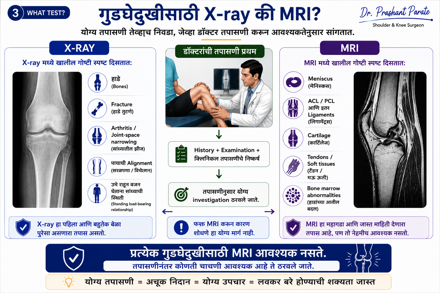 गुडघेदुखीसाठी X-ray की MRI? योग्य तपासणी कशी निवडावी. X-ray आणि MRI मध्ये काय दिसते. डॉ. प्रशांत पराते
